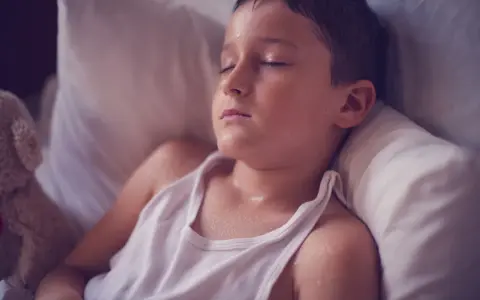 Un niño duerme con la cabeza sudada, quizás por una fiebre o porque un niño suda mucho la cabeza al dormir.