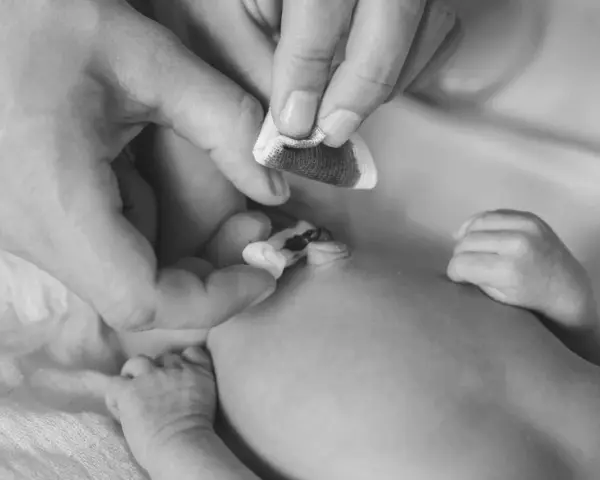 Manos cuidadosas limpian el cordón umbilical de un recién nacido con una gasa.