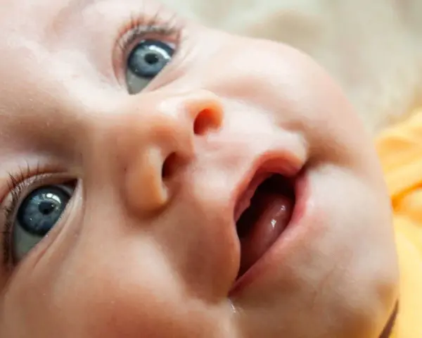Bebé con ojos azules y boca abierta, mostrando las encías y los primeros dientes saliendo.