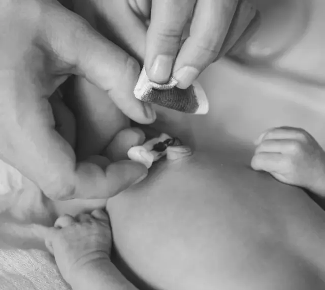 Manos cuidadosas limpian el cordón umbilical de un recién nacido con una gasa.