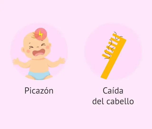 Síntomas de la costra láctea: enrojecimiento, picazón, caída del cabello y escamas amarillas.