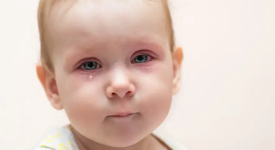 Bebé con ojos rojos e irritados, una lágrima cayendo, indicativo de conjuntivitis vírica.