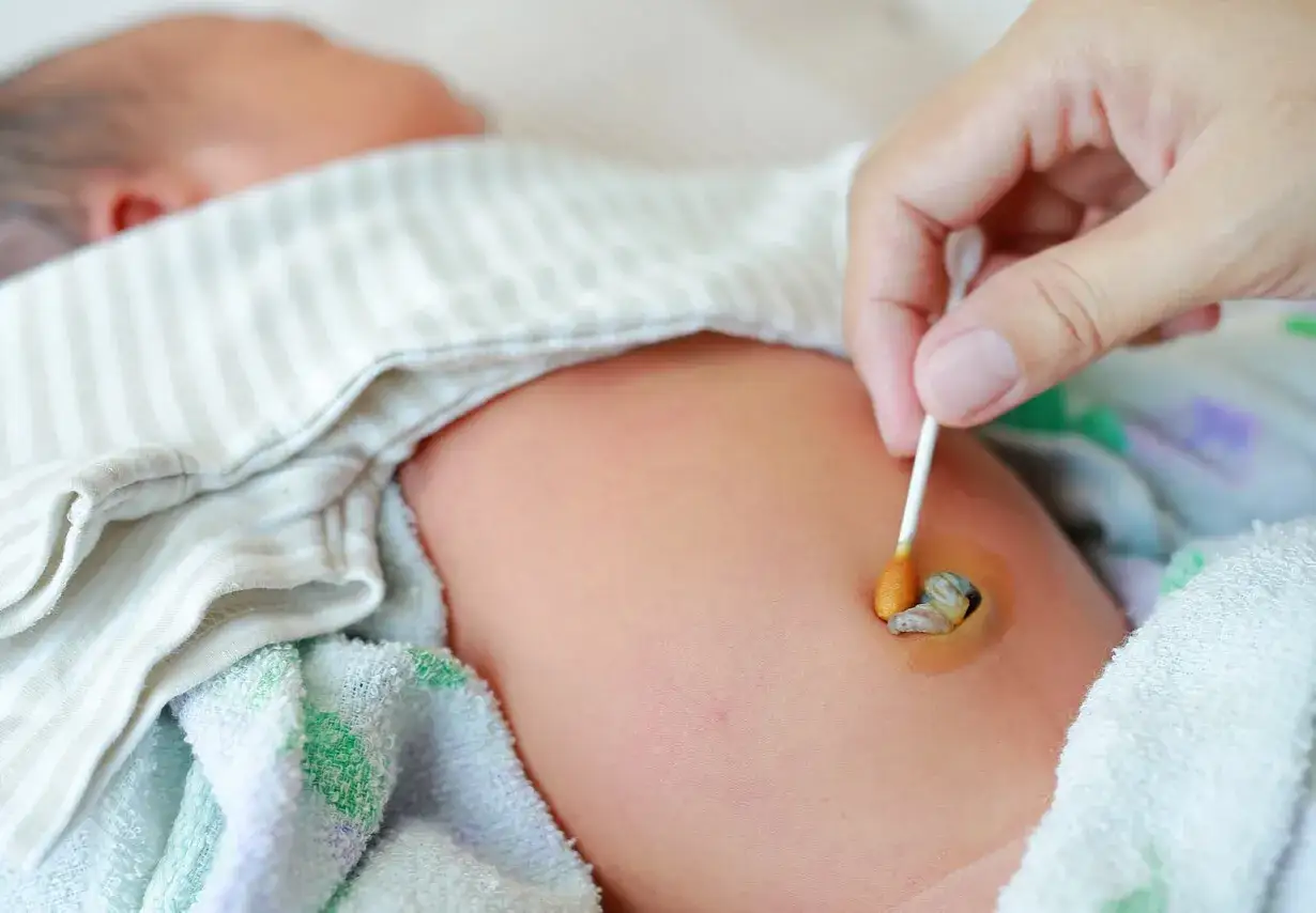 Cuidado del ombligo de un bebé. Una mano usa un hisopo para limpiar el cordón umbilical, previniendo un ombligo con mal olor.
