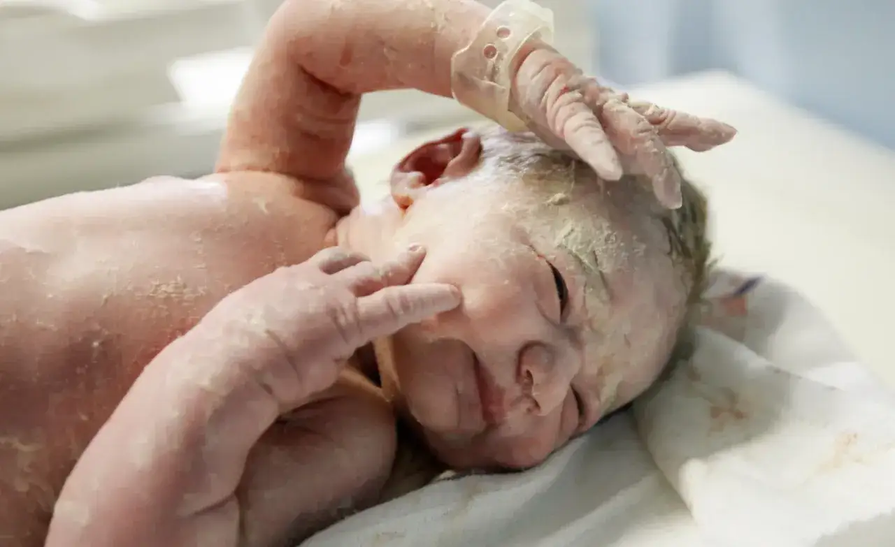 Reci&eacute;n nacido cubierto de vernix, con una mano tocando su cara.