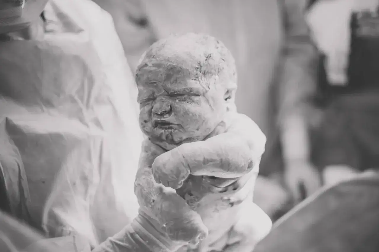 Reci&eacute;n nacido cubierto de vernix, un recubrimiento protector natural. Su piel parece una obra de arte.