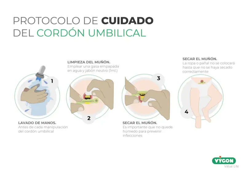 Guía para saber como limpiar el ombligo del bebe: lava manos, limpia el muñón con gasa y jabón neutro, sécalo bien para prevenir infecciones.